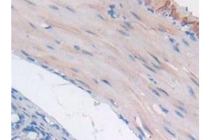 DAB staining on IHC-P; Samples: Mouse Small intestine Tissue (GAA Antikörper  (AA 755-953))