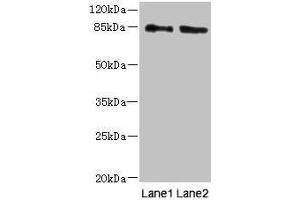 Western blot All lanes: HOOK1 antibody at 4 μg/mL Lane 1: 293T whole cell lysate Lane 2: MCF-7 whole cell lysate Secondary Goat polyclonal to rabbit IgG at 1/10000 dilution Predicted band size: 85, 81 kDa Observed band size: 85 kDa (HOOK1 Antikörper  (AA 301-600))