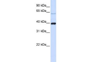WB Suggested Anti-PHF6 Antibody Titration:  0. (PHF6 Antikörper  (C-Term))