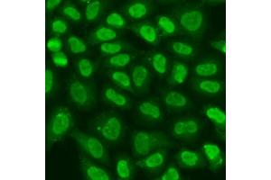Immunofluorescence analysis of U2OS cells using TERF2IP antibody  at dilution of 1:100. (RAP1 Antikörper  (AA 1-280))