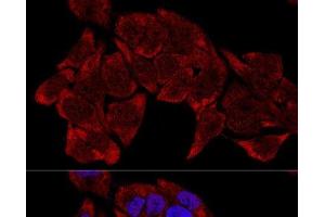 Confocal immunofluorescence analysis of HeLa cells using RPL8 Polyclonal Antibody at dilution of 1:200. (RPL8 Antikörper)