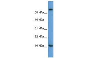 Image no. 1 for anti-Chemokine (C-C Motif) Ligand 20 (CCL20) (AA 31-80) antibody (ABIN6746017) (CCL20 Antikörper  (AA 31-80))