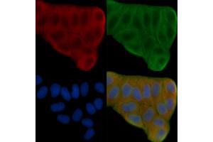 ABIN6264161 and ABIN6276567 staining Hela cells(30 min of UV treatment) by IF/ICC.