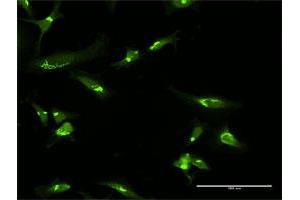 Immunofluorescence (IF) image for anti-Golgin A2 (GOLGA2) (AA 1-990) antibody (ABIN947930)
