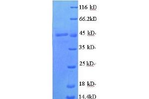 Transcobalamin I (Vitamin B12 Binding Protein, R Binder Family) (TCN1) (AA 25-416), (full length) protein (His tag) (TCN1 Protein (AA 25-416, full length) (His tag))