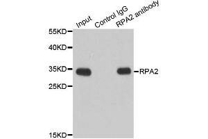 Immunoprecipitation analysis of 200ug extracts of Jurkat cells using 1ug RPA2 antibody. (RPA2 Antikörper)