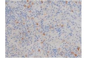 ABIN6256195 and ABIN6267353 at 1/200 staining Rat spleen tissue sections by IHC-P.