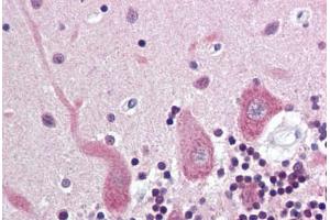 Human Brain, Cerebellum (formalin-fixed, paraffin-embedded) stained with Synuclein Alpha/Beta antibody ABIN337058 at 5-10 ug/ml followed by biotinylated anti-mouse IgG secondary antibody ABIN481714, alkaline phosphatase-streptavidin and chromogen. (Alpha, beta Synuclein Antikörper)