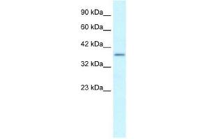 Human heart; WB Suggested Anti-SOX18 Antibody Titration: 0.