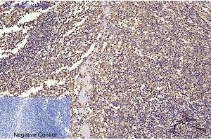 Immunohistochemical analysis of paraffin-embedded human tonsil tissue. (CD68 Antikörper)