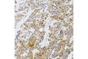 Immunohistochemistry (IHC) image for anti-Apoptosis-Inducing Factor, Mitochondrion-Associated, 3 (AIFM3) (AA 1-200) antibody (ABIN6136680)