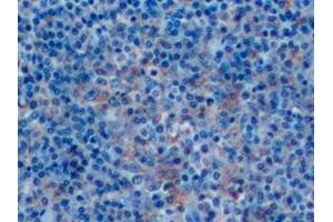 Immunohistochemistry (IHC) image for anti-CD14 (CD14) (AA 125-288) antibody (ABIN7432388)