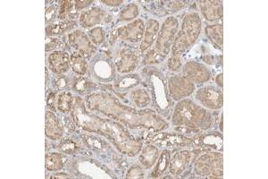 Immunohistochemical staining of human kidney with GNB1L polyclonal antibody  shows moderate cytoplasmic positivity in tubular cells at 1:50-1:200 dilution.