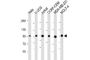All lanes : Anti-RANBP9 Antibody at 1:2000-1:4000 dilution Lane 1: Hela whole cell lysate Lane 2: U-2OS whole cell lysate Lane 3: Jurkat whole cell lysate Lane 4: CCRF-CEM whole cell lysate Lane 5: MDA-MB-231whole cell lysate Lane 6: MOLT-4 whole cell lysate Lysates/proteins at 20 μg per lane. (Importin 9 Antikörper  (AA 1-388))