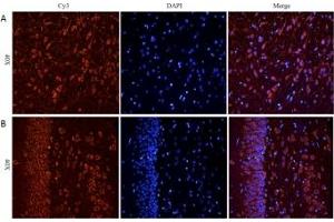 IHC staining of FFPE rat cerebral cortex [A] and rat hippocampus [B] with CHRNA antibody at 5ug/ml (CHRNA7 Antikörper)