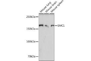 SMC1A Antikörper