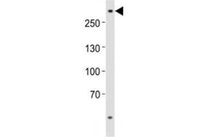 Western blot analysis of lysate from U-87 MG cell line using ABCA2 antibody at 1:1000. (ABCA2 Antikörper  (AA 1339-1373))