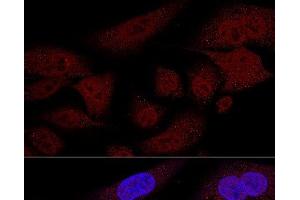 Confocal immunofluorescence analysis of U2OS cells using TAZ Polyclonal Antibody at dilution of 1:100 (60x lens). (TAZ Antikörper)