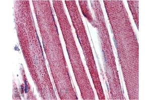 Immunohistochemistry analysis of human skeletal muscle tissue stained with Mn SOD, pAb at 10 μg/mL. (SOD2 Antikörper)