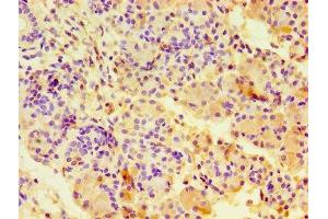 Immunohistochemistry of paraffin-embedded human pancreatic tissue using ABIN7146703 at dilution of 1:100 (CA12 Antikörper  (AA 25-301))