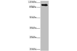 Western blot All lanes: TGFBR3 antibody IgG at 2. (TGFBR3 Antikörper  (AA 140-340))