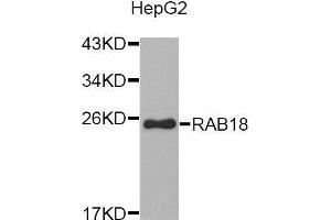 Western blot analysis of extracts of HepG2 cell line, using RAB18 antibody. (RAB18 Antikörper  (AA 1-206))