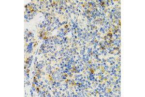 Immunohistochemistry of paraffin-embedded mouse spleen using SH2B1 Antibody (ABIN5973245) at dilution of 1/100 (40x lens). (SH2B1 Antikörper)