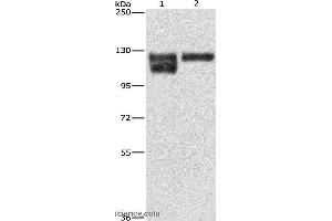 Western blot analysis of A172 cell and human leiomyosarcoma tissue, using ITGB1 Polyclonal Antibody at dilution of 1:600 (ITGB1 Antikörper)