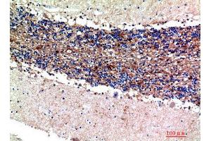 Immunohistochemistry (IHC) analysis of paraffin-embedded Human Brain, antibody was diluted at 1:200. (S100A1 Antikörper)