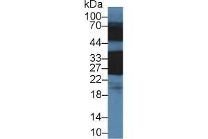 Western Blotting (WB) image for anti-Crystallin, beta B1 (CRYBB1) (AA 6-186) antibody (ABIN7442405)