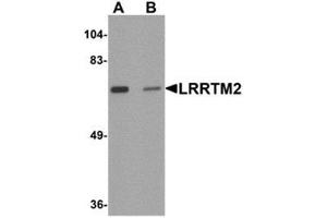 Western blot analysis of LRRTM2 in SK-N-SH cell lysate with LRRTM2 antibody at 1 μg/ml in (A) the absence and (B) the presence of blocking peptide. (LRRTM2 Antikörper  (C-Term))