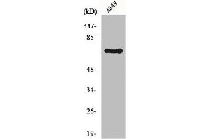 Western Blot analysis of A549 cells using Frizzled-3 Polyclonal Antibody (FZD3 Antikörper  (Internal Region))