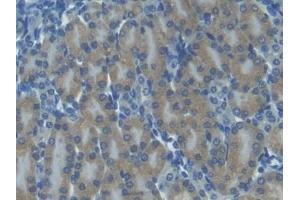 Immunohistochemistry (IHC) image for anti-Chemokine (C-X-C Motif) Ligand 11 (CXCL11) (AA 22-100) antibody (ABIN7440752)
