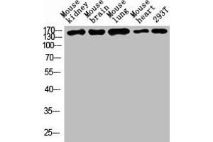 Western blot analysis of Mouse kidney tissue, Mouse brain tissue, Mouse lung tissue, Mouse heart tissue, 293T whole cell lysate, antibody was diluted at 1000. (Desmoglein 1 Antikörper  (AA 30-90))