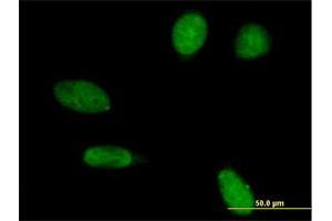 Immunofluorescence of purified MaxPab antibody to EMD on HeLa cell. (Emerin Antikörper  (AA 1-254))