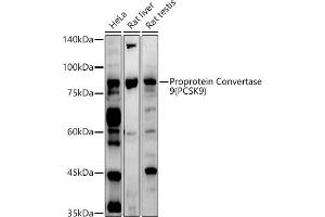 Western blot analysis of extracts of various cell lines, using Proprotein Convertase 9(PCSK9) antibody (ABIN6133851, ABIN6145328, ABIN6145330 and ABIN6223837) at 1:1000 dilution. (PCSK9 Antikörper  (C-Term))