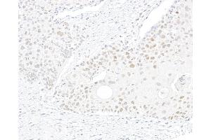Immunohistochemistry (IHC) image for anti-Bloom Syndrome RecQ Like Helicase (BLM) (C-Term) antibody (ABIN7795726)
