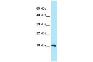 WB Suggested Anti-GGNBP1 Antibody Titration: 1. (GGNBP1 Antikörper  (N-Term))