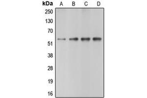 Western blot analysis of Caspase 10 expression in HeLa (A), Jurkat (B), mouse heart (C), rat heart (D) whole cell lysates. (Caspase 10 Antikörper  (C-Term))