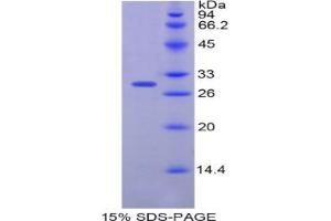 SDS-PAGE analysis of Human Plastin 3 Protein. (Plastin 3 Protein (PLS3))