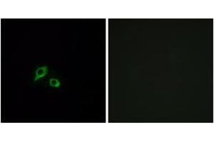 Immunofluorescence analysis of MCF7 cells, using GIPR Antibody. (GIPR Antikörper  (AA 93-142))