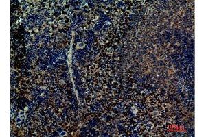 Immunohistochemistry (IHC) image for anti-Integrin alpha 4 (ITGA4) (Internal Region) antibody (ABIN3187778)
