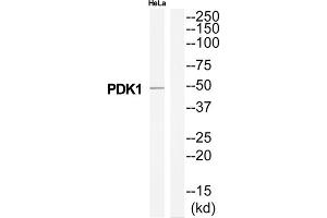 Western Blotting (WB) image for anti-3-phosphoinositide Dependent Protein Kinase-1 (PDPK1) (Internal Region) antibody (ABIN1851913) (PDPK1 Antikörper  (Internal Region))