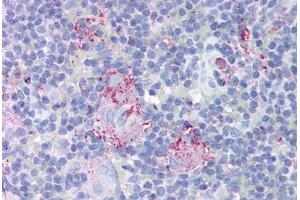 Human Thymus (formalin-fixed, paraffin-embedded) stained with MTBP antibody ABIN213954 at 10 ug/ml followed by biotinylated goat anti-rabbit IgG secondary antibody ABIN481713, alkaline phosphatase-streptavidin and chromogen. (MTBP Antikörper  (AA 122-139))