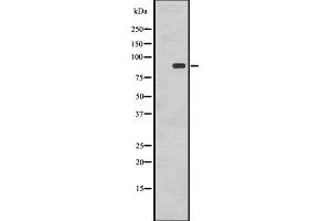 Western Blotting (WB) image for anti-Ribosomal Protein S6 Kinase, 90kDa, Polypeptide 1 (RPS6KA1) (pSer363), (pThr359) antibody (ABIN6255259)