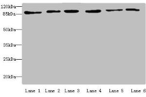 Western blot All lanes: MCM3 antibody at 4 μg/mL Lane 1: Hela whole cell lysate Lane 2: 293T whole cell lysate Lane 3: K562 whole cell lysate Lane 4: HepG2 whole cell lysate Lane 5: Jurkats whole cell lysate Lane 6: U917 whole cell lysate Secondary Goat polyclonal to rabbit IgG at 1/10000 dilution Predicted band size: 91, 96 kDa Observed band size: 91 kDa (MCM3 Antikörper  (AA 1-295))