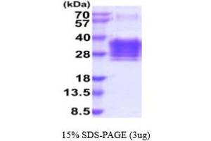 SDS-PAGE (SDS) image for Orosomucoid 2 (ORM2) (AA 19-201) protein (His tag) (ABIN5854831) (Orosomucoid 2 Protein (ORM2) (AA 19-201) (His tag))