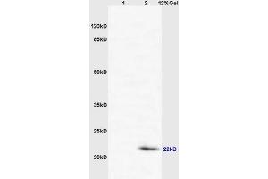 Lane 1: mouse intestine brain lysates Lane 2: mouse lung lysates probed with Anti CD69/CLEC2C/AIM Polyclonal Antibody, Unconjugated (ABIN741150) at 1:200 in 4 °C.