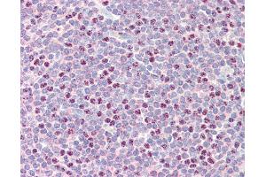 Anti-RAD51B antibody IHC staining of human tonsil. (RAD51 Homolog B Antikörper  (AA 143-192))