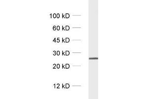 dilution: 1 : 1000, sample: crude synaptosomal fraction of rat brain (P2) (RAB5 Antikörper)